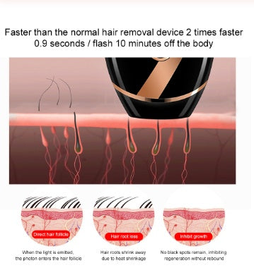 At-Home IPL Hair Removal Device, detail view 7